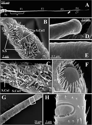 Characterization of Antennal Sensilla and Immunolocalization of Odorant-Binding Proteins on Spotted Alfalfa Aphid, Therioaphis trifolii (Monell)